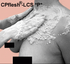 Körper-Abformsilikon  Cpflesh®-LCS